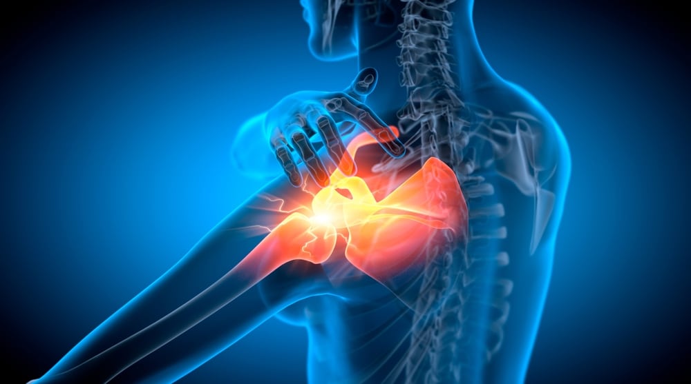 Workers' Comp Shoulder Injury Settlement - Kitay Law Offices